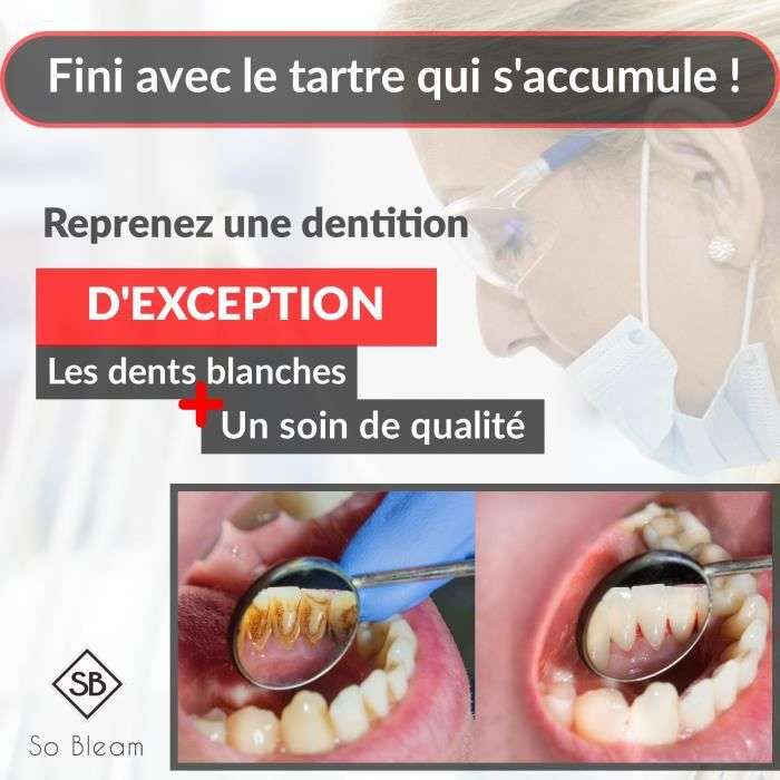 Détartreur dentaire ultrason + kit de 5 capsules blanchiment dentaire &  polissage (vendeur tiers) –